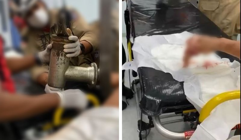 Açougueiro tem mão amputada em acidente com máquina de moer carne em Manaus